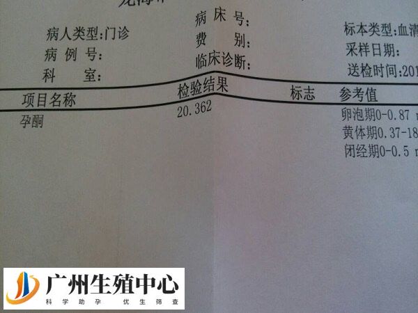试管移植前孕酮低影不影响着床